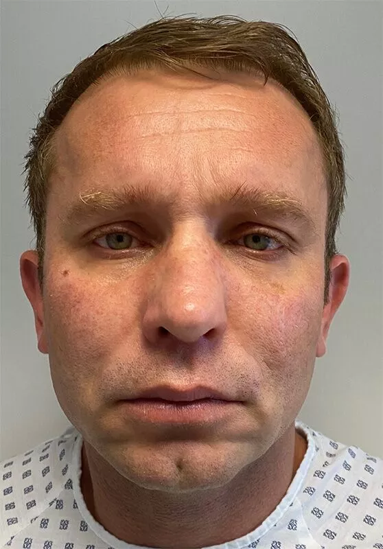 After image
