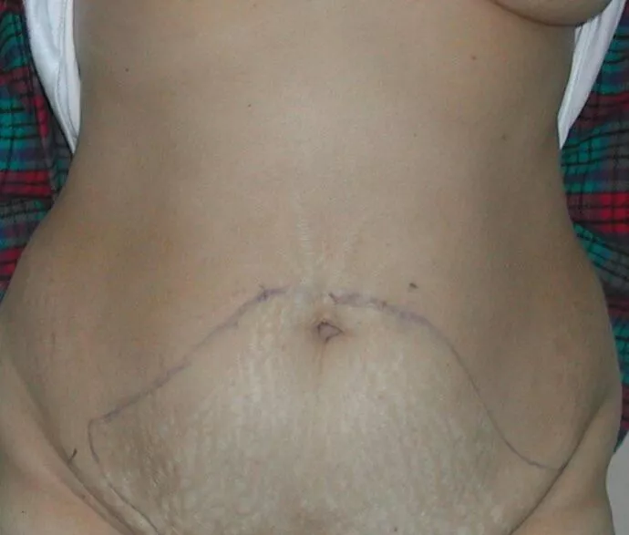 After image